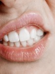 infección, hongos, infecciones bucales, infecciones bacterianas, candidiasis, úlceras, herpes, biofilm oral
